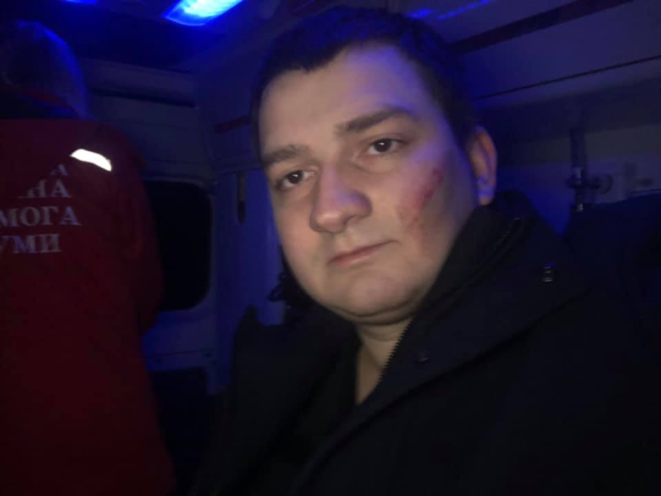 В Сумах избили нардепа-"слугу" 1